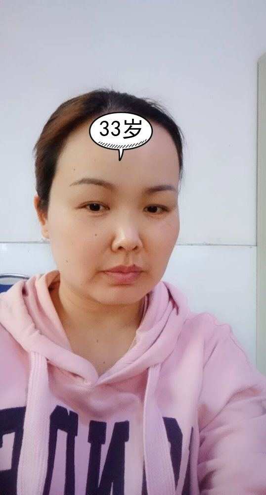 拍照测年龄_百度拍照测年龄_拍照测年龄的app