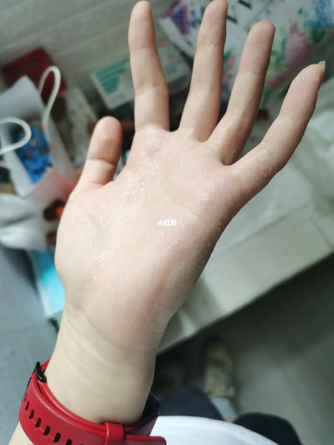手机屏出汗打游戏不方便_手机屏幕打游戏有汗怎么办_冬天打游戏手机屏幕有汗