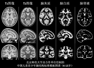 1岁半孩子玩手机游戏好吗-1岁半宝宝玩手机游戏？专家说NO，